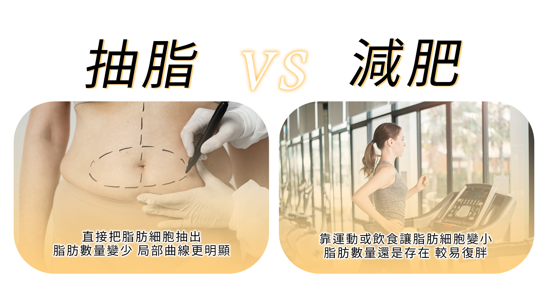 抽脂原理