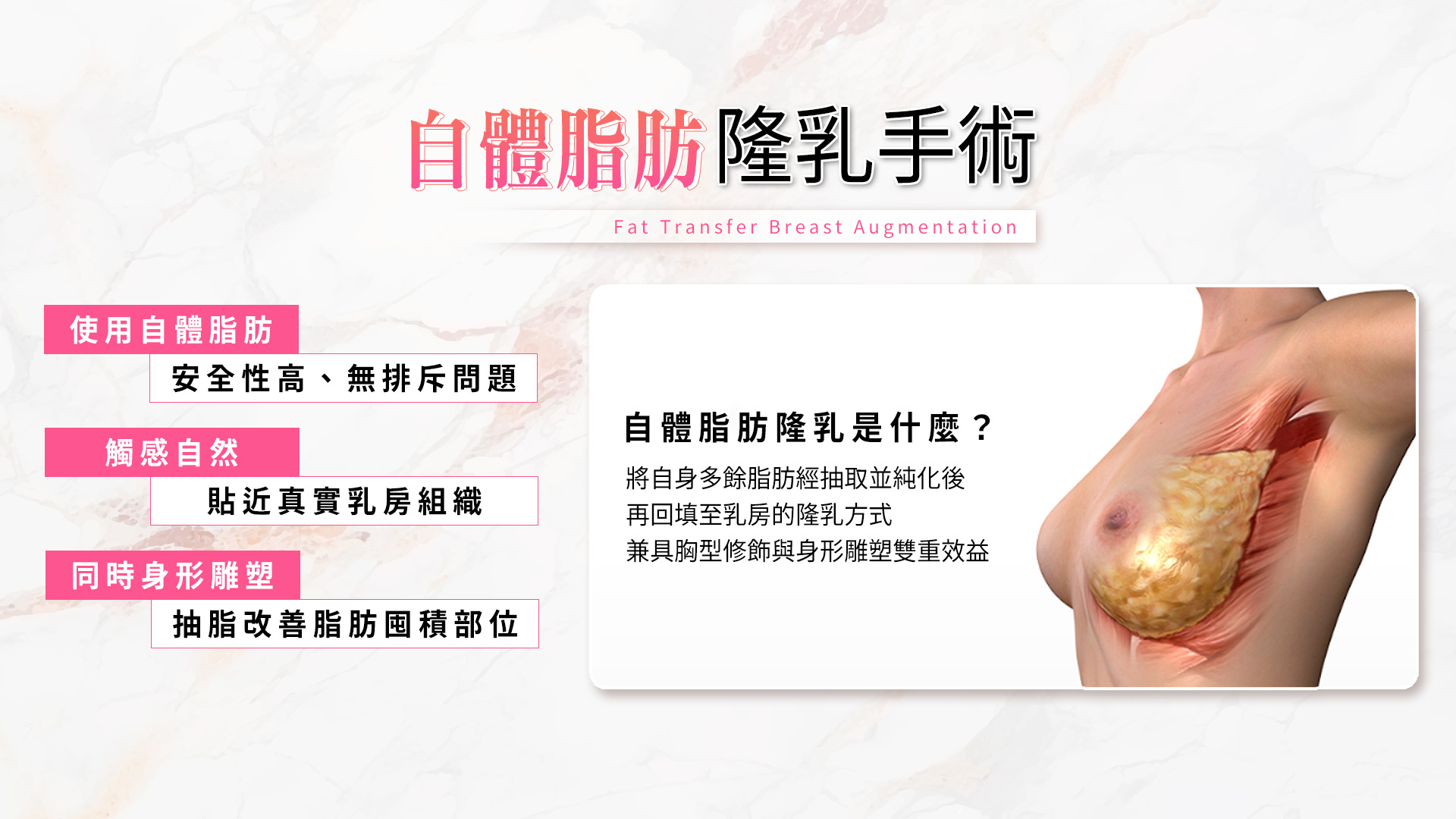 台南自體脂肪隆乳手術原理說明