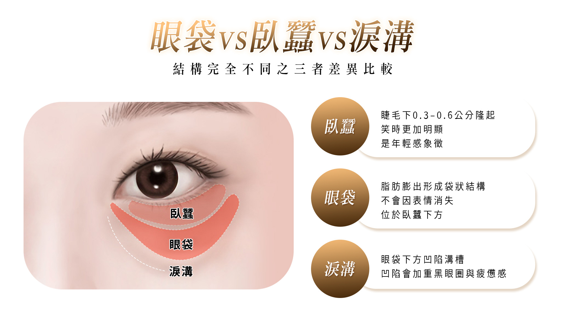 眼袋、臥蠶、淚溝比較