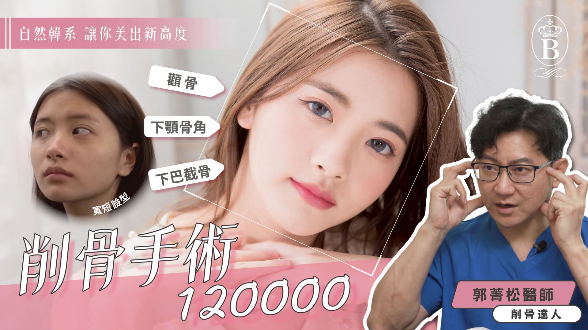 台南削骨手術權威醫師推薦郭菁松醫師001